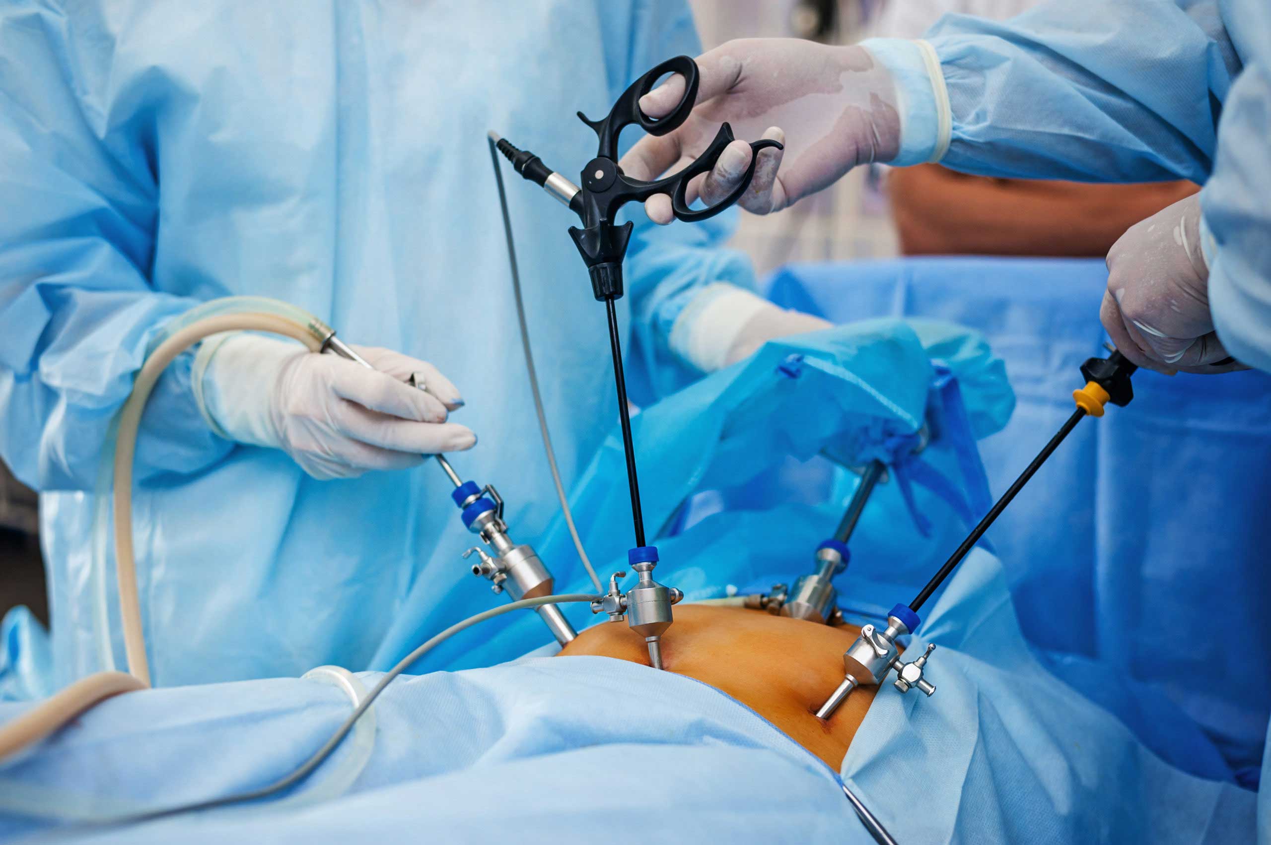 Laparoscopic Hysterectomy surgeon in Ravet