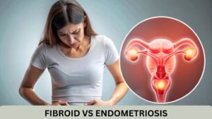 Fibroid vs Endometriosis: Symptoms, Causes & Treatment in Ravet